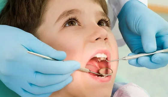 Criança em atendimento odontológico, com o dentista usando espelho e sonda